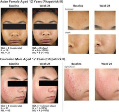 Mitigating GHK-Cu Injection Pain: Tips and Tricks | Gabriel Alizaidy, MD, MS posted on the topic