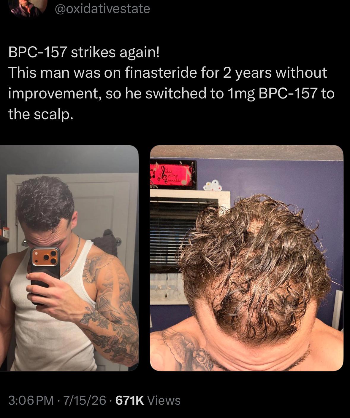 bpc 157 hair growth evidence studies What's the deal with Musculoskeletal and Tissue Healing with –