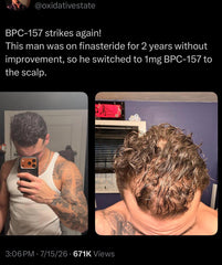 bpc 157 hair growth evidence studies What's the deal with Musculoskeletal and Tissue Healing with –